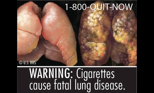 FDA Cigarette Warning Labels