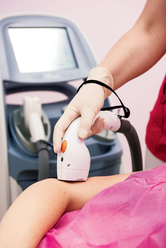 laser hair removal dc