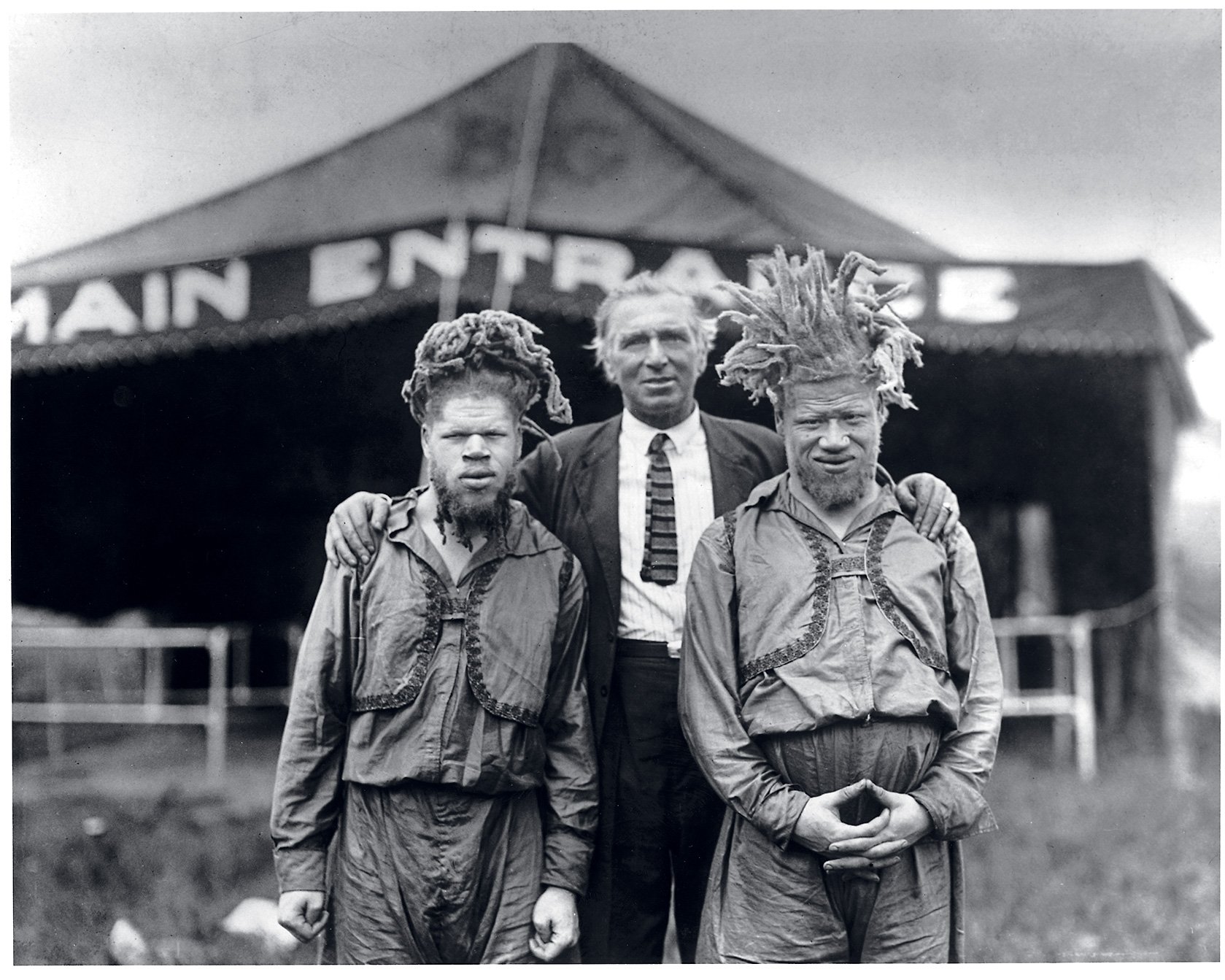 In the Early 1900s, Albino African-American Brothers Were Stolen From Their Virginia Home to Be Circus Performers. This Is Their Story.