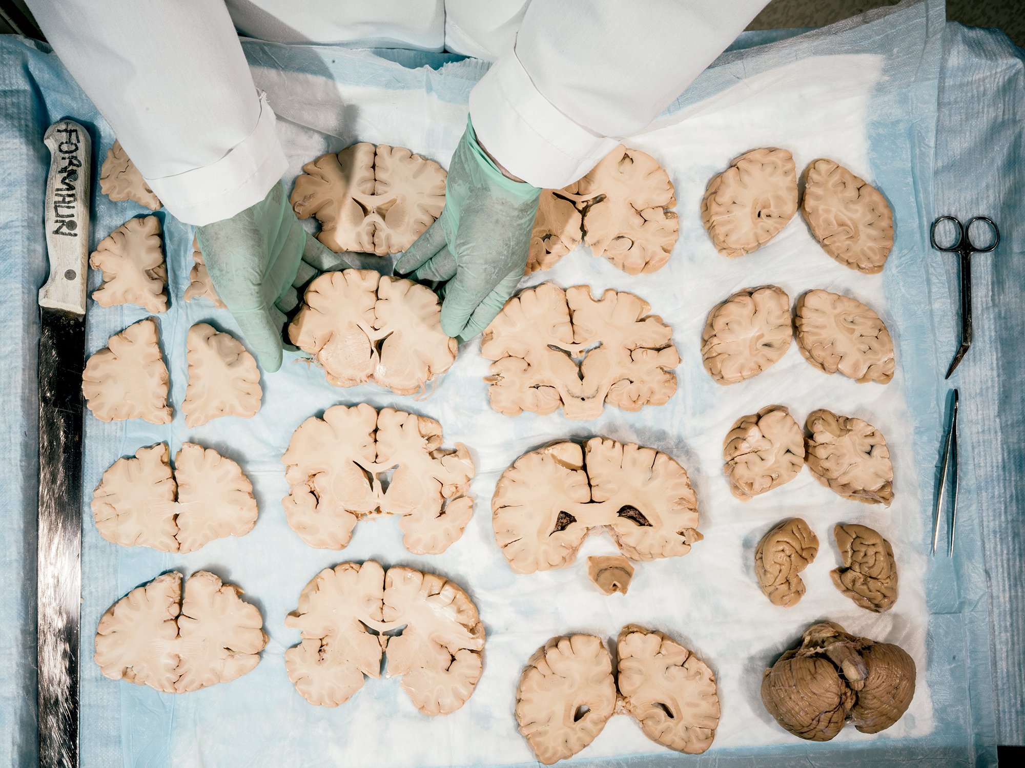 Human brains awaiting study at NIH's brain bank, which Lipska has led since 2013. Photograph by Greg Kahn. 