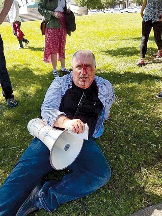 Murat Yasa, a 61-year-old Kurdish-American, was also hospitalized. Photograph courtesy of Murat Yasa. Murat Yasa, a 61-year-old Kurdish-American, was also hospitalized. Photograph courtesy of Murat Yasa.