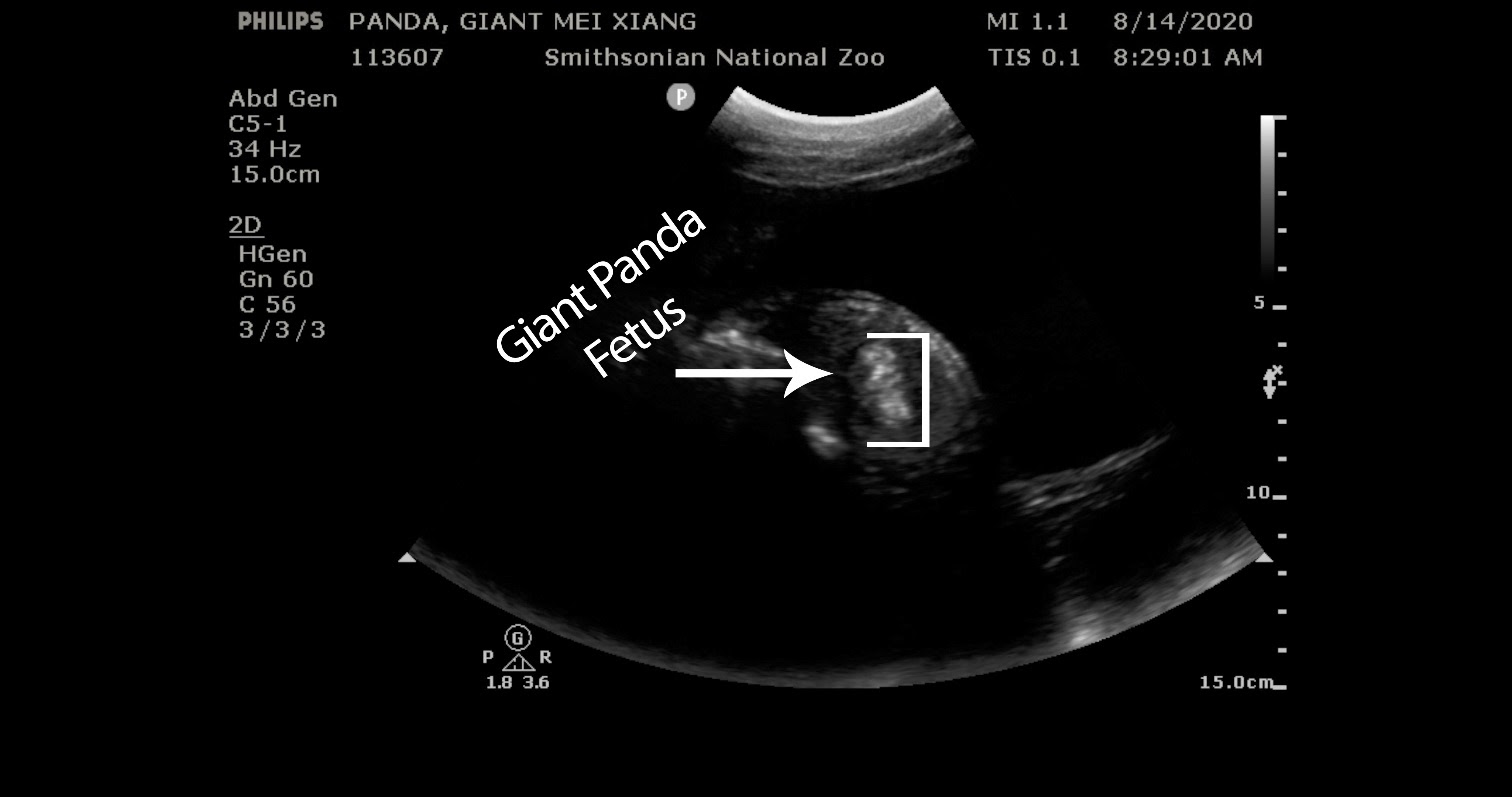 panda-fetus - Washingtonian